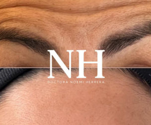 Galería de imagen 1